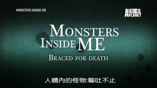 Monsters Inside Me Season 8 Episode 7 - Braced for Death