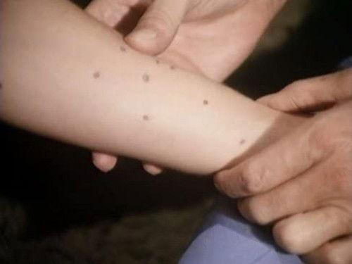 Marcus Welby, M.D. Season 1 Episode 12 - The Chemistry of Hope