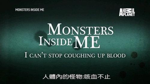Monsters Inside Me Season 8 Episode 8 - I Can't Stop Coughing Up Blood