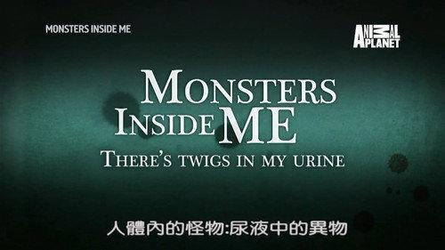 Monsters Inside Me Season 8 Episode 12 - There Are Twigs In My Urine