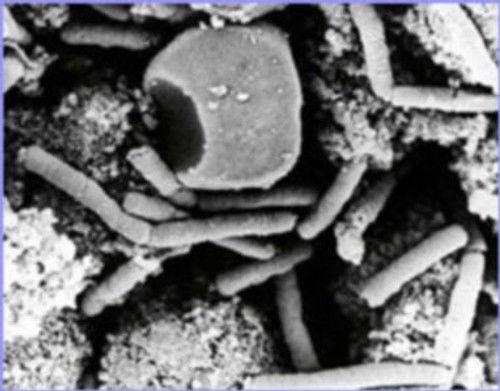 NOVA Season 29 Episode 6 - Bioterror