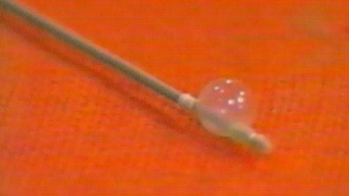 Sonda Season 1 Episode 86 - Episode 86