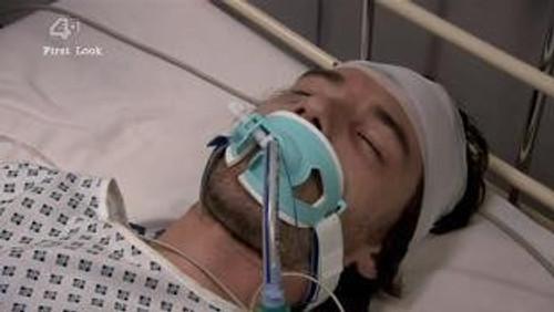 Shameless Season 6 Episode 9 - Episode 9