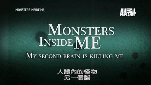 Monsters Inside Me Season 8 Episode 3 - My Second Brain Is Killing Me