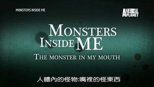 Monsters Inside Me Season 8 Episode 4 - The Monster in My Mouth