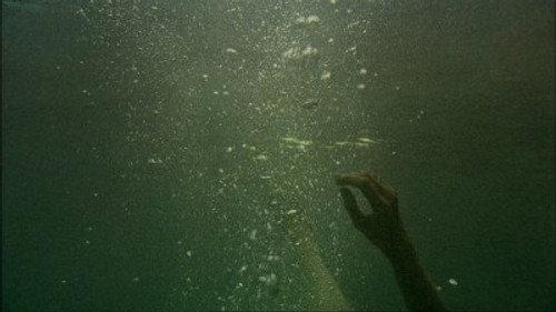 Sensitive Skin Season 2 Episode 6 - Here I Am