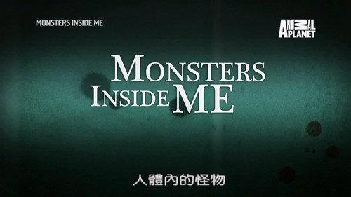 Monsters Inside Me Season 7 Episode 5 - My Hands Are Falling Off