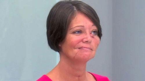 Botched Season 6 Episode 18 - Hopeful Transformations