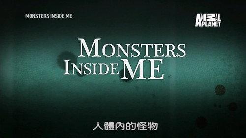 Monsters Inside Me Season 7 Episode 3 - There's Something Living In My Hand!