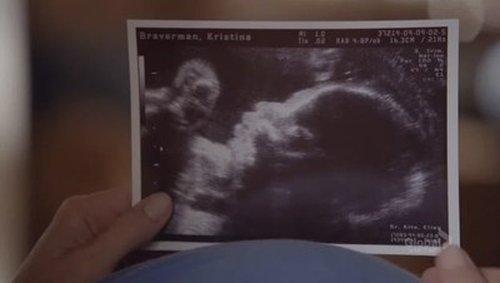 Parenthood Season 3 Episode 3 - Step Right Up