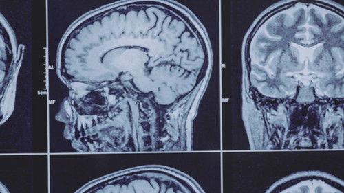 The UnXplained Season 7 Episode 16 - Unlocking the Sixth Sense