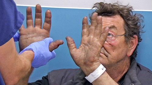 24 Hours in A&E Season 11 Episode 11 - One False Move