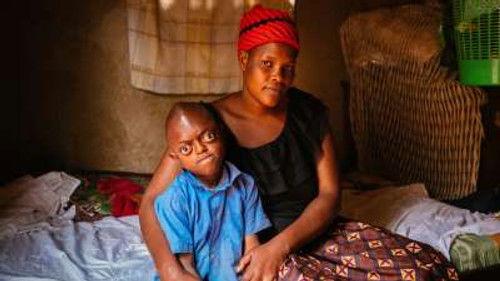 Body Bizarre Season 6 Episode 8 - The Boy who's eyes fall out