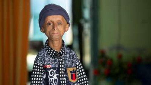 Body Bizarre Season 6 Episode 16 - Living With A Stranger's Face