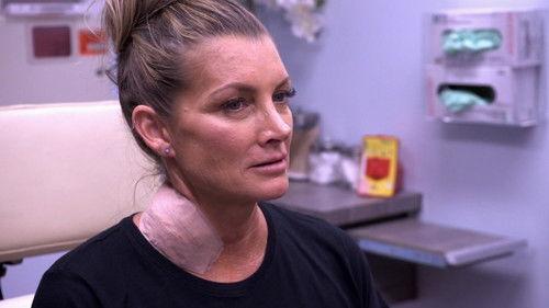 Dr. Pimple Popper Season 1 Episode 2 - The World's Largest Lump