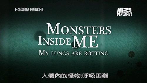 Monsters Inside Me Season 8 Episode 10 - My Lungs Are Rotting