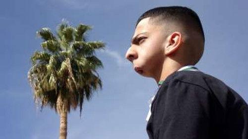 Body Bizarre Season 6 Episode 5 - Boy with no Jaw