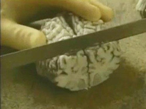 Forensic Files Season 3 Episode 4 - Foreign Body