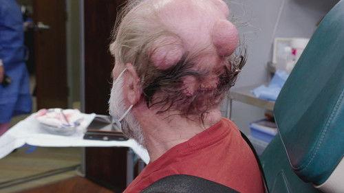 Dr. Pimple Popper Season 5 Episode 3 - Cystic River