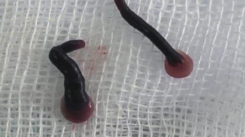 Strange Evidence Season 5 Episode 10 - Mystery of the Face Parasite