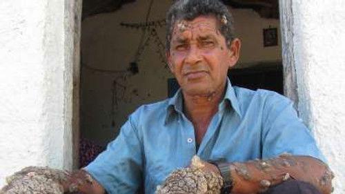 Body Bizarre Season 6 Episode 4 - The Teen who wants a voice