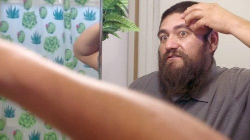 Dr. Pimple Popper Season 2 Episode 7 - Scared Cyst-less