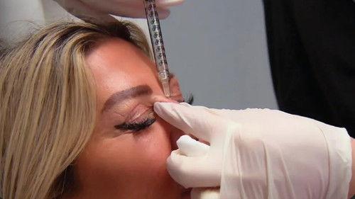 Botched Season 8 Episode 7 - London's Nose Is Falling Down
