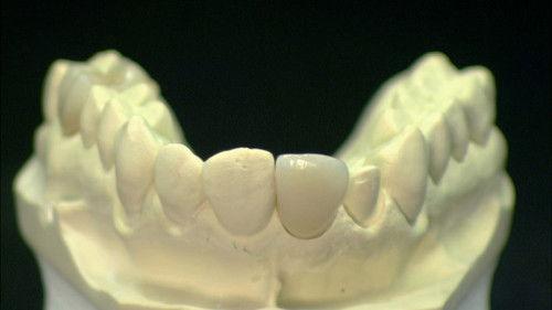 How It's Made Season 15 Episode 1 - Kelp Caviar, Luxury Sailboats, Dental Crowns, High-Performance Engines