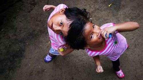 Body Bizarre Season 6 Episode 10 - Joined at the Head