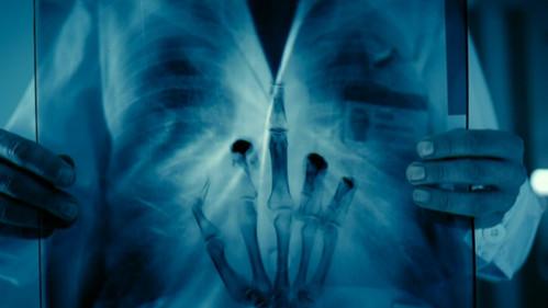 The Interns Season 2 Episode 53 - Episode 53