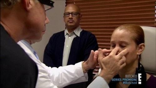 Botched Season 1 Episode 1 - Human Dolls