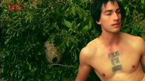 Sex Sent Me to the ER Season 1 Episode 14 - Drama Down Under