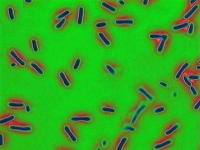 Forensic Files Season 7 Episode 8 - Bio-Attack