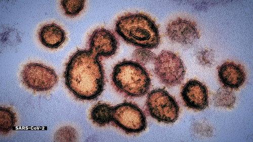 Coronavirus, Explained Season 1 Episode 1 - This Pandemic