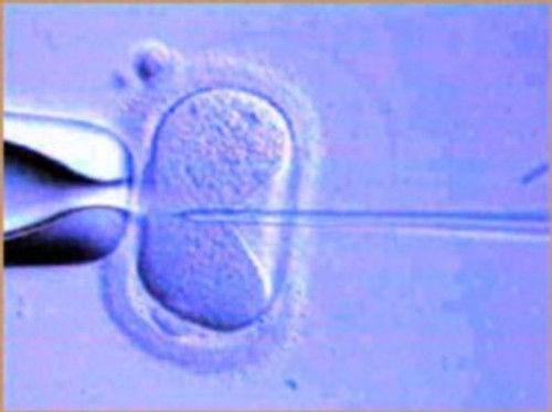 NOVA Season 29 Episode 2 - 18 Ways to Make a Baby