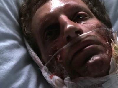 Shark Season 2 Episode 9 - Burning Sensation