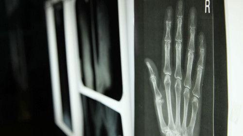 Dissected Season 1 Episode 1 - The Incredible Human Hand