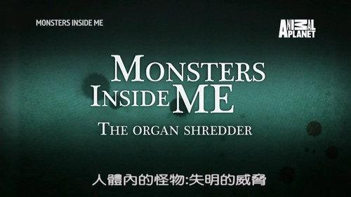 Monsters Inside Me Season 8 Episode 9 - The Organ Shredder