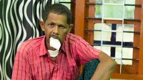 Body Bizarre Season 6 Episode 17 - My Child's Huge Hands