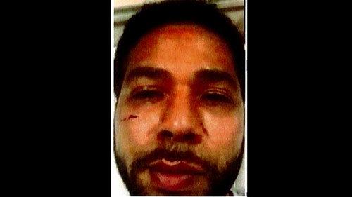 Jussie Smollett: Anatomy of a Hoax Season 1 Episode 1 - The "Attack"