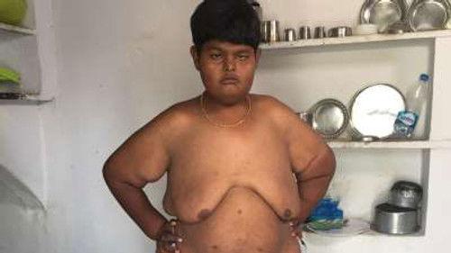 Body Bizarre Season 6 Episode 7 - Boy with no eyes