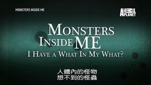 Monsters Inside Me Season 7 Episode 2 - I Have a What in my What?