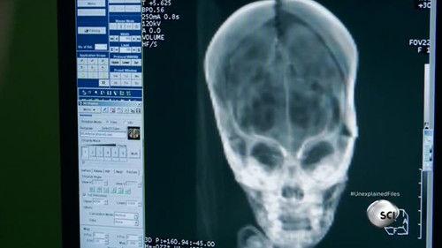 The Unexplained Files Season 2 Episode 2 - Peruvian Alien Skull & Baltic Sea UFO