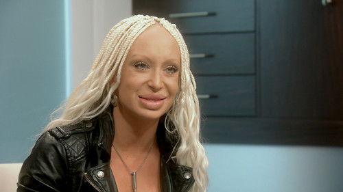 Botched Season 3 Episode 11 - Blowfish Lips and Crab Claw Bits