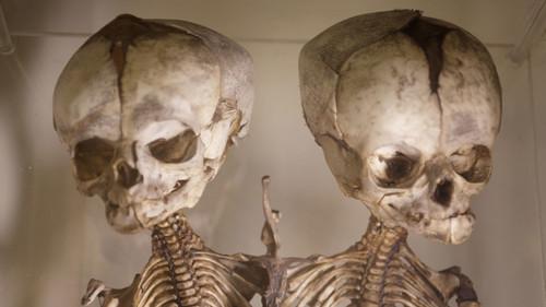 Somebody's Gotta Do It Season 1 Episode 7 - Mutter Museum