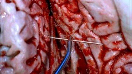 CSI: NY Season 4 Episode 4 - Time's Up