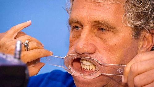 De Pfaffs Season 11 Episode 3 - Aflevering 3