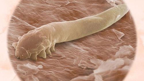 Explained Season 3 Episode 7 - Your Skin