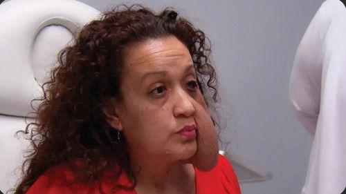 Botched Season 8 Episode 20 - Tumor Tragedy