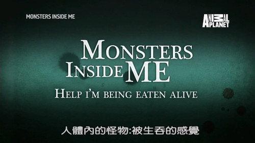 Monsters Inside Me Season 8 Episode 1 - Help! I'm Being Eaten Alive